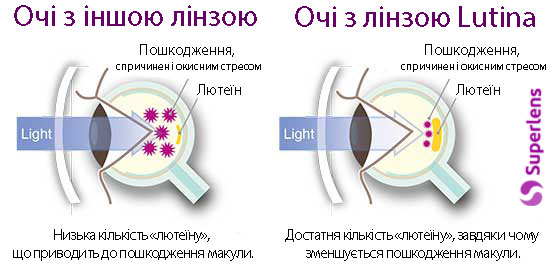 В этих линзах используется уникальная технология, которая помогает защитить глаза от вредного синего света, снижая риск перенапряжения глаз и возрастной дегенерации желтого пятна.